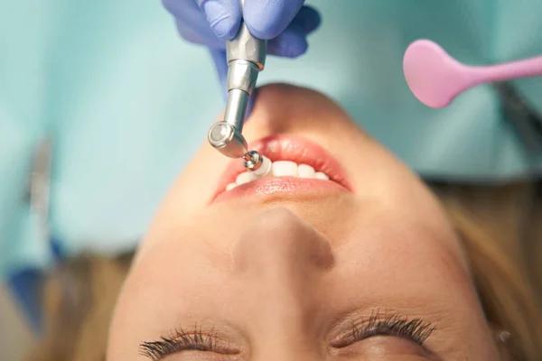 Professional Dental Cleaning After Braces: Why It’s Essential